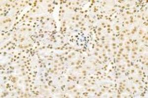 Immunohistochemistry (Paraffin-embedded Sections) (IHC (p)) image for anti-Pinin, Desmosome Associated Protein (PNN) antibody (ABIN7075083)