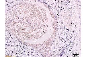 Immunohistochemistry (IHC) image for anti-Lymphatic Vessel Endothelial Hyaluronan Receptor 1 (LYVE1) (AA 231-318) antibody (ABIN674799)
