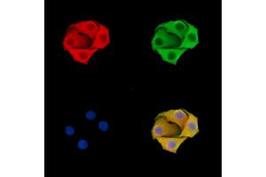 ABIN6260909 and ABIN6279332 staining Hela cells by IF/ICC.