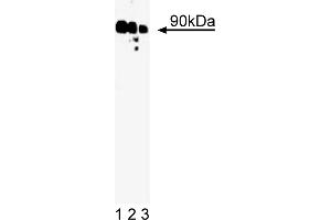 Western Blotting (WB) image for anti-Ribosomal Protein S6 Kinase, 90kDa, Polypeptide 1 (RPS6KA1) (AA 1-184) antibody (ABIN967838)