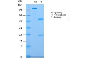 SDS-PAGE Analysis of Purified CELA3B Rabbit Recombinant Monoclonal Antibody (CELA3B/2809R). (Rekombinanter Elastase 3B Antikörper  (AA 82-238))