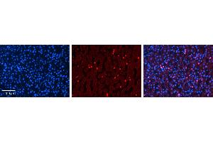 Immunohistochemistry (IHC) image for anti-Cytochrome P450, Family 3, Subfamily A, Polypeptide 4 (CYP3A4) (Middle Region) antibody (ABIN2783885) (CYP3A4 Antikörper  (Middle Region))