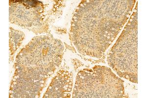 ABIN6255185 and ABIN6267483 at 1/100 staining Rat colon tissue by IHC-P. (IRS1 Antikörper  (pSer307))
