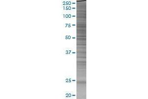 Western Blotting (WB) image for HSPB8 293T Cell Transient Overexpression Lysate(Denatured) (ABIN1335905)