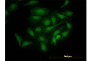 Immunofluorescence (IF) image for anti-PDZ Binding Kinase (PBK) (AA 1-110) antibody (ABIN527757)