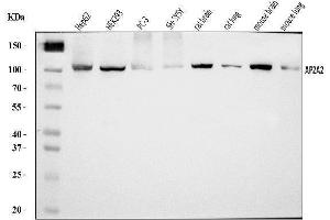 Western blot analysis of AP2A2 using anti-AP2A2 antibody (ABIN7602295).