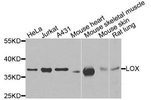 Western blot analysis of extracts of various cell lines, using LOX antibody. (LOX Antikörper)