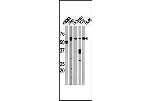 Western Blotting (WB) image for anti-Beclin 1, Autophagy Related (BECN1) (AA 210-239) antibody (ABIN388546)