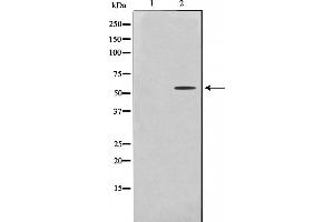Western blot analysis on HeLa cell lysate using Cytochrome P450 2U1 Antibody，The lane on the left is treated with the antigen-specific peptide. (CYP2U1 Antikörper  (Internal Region))