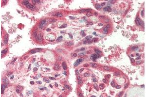 Human Placenta (formalin-fixed, paraffin-embedded) stained with NAIP antibody ABIN214411 at 5 ug/ml followed by biotinylated goat anti-rabbit IgG secondary antibody ABIN481713, alkaline phosphatase-streptavidin and chromogen. (NAIP Antikörper  (C-Term))