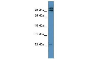 Western Blot showing MRPL49 antibody used at a concentration of 1-2 ug/ml to detect its target protein. (MRPL49 Antikörper  (N-Term))