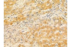 ABIN6257587 and ABIN6274867 at 1/100 staining human normal liver tissue by IHC-P. (ARSF Antikörper  (Internal Region))