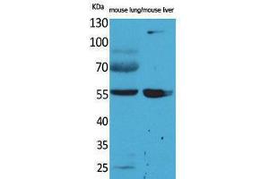 Western Blotting (WB) image for anti-Aldehyde Dehydrogenase 1 Family, Member A1 (ALDH1A1) (N-Term) antibody (ABIN3187700) (ALDH1A1 Antikörper  (N-Term))