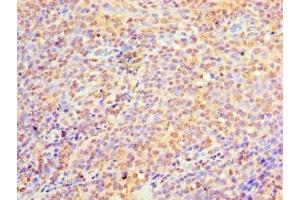 Immunohistochemistry of paraffin-embedded human tonsil tissue using ABIN7174912 at dilution of 1:100 (C9orf163 Antikörper  (AA 1-203))