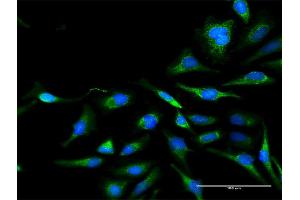 Immunofluorescence (IF) image for anti-Dihydrolipoyl Transacetylase (DLAT) (AA 1-647) antibody (ABIN947793)