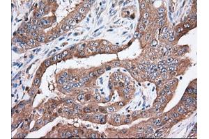 Immunohistochemical staining of paraffin-embedded Human Kidney tissue using anti-TTC32 mouse monoclonal antibody. (TTC32 Antikörper)