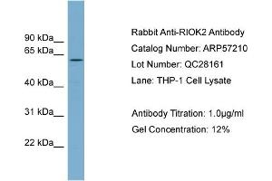 WB Suggested Anti-RIOK2  Antibody Titration: 0. (RIOK2 Antikörper  (Middle Region))