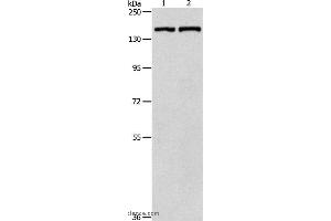 Western blot analysis of Hela cell and mouse lung tissue, using PTCH1 Polyclonal Antibody at dilution of 1:900 (Patched 1 Antikörper)