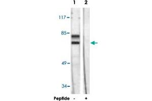 Western blot analysis of extracts from HeLa cells, using LMNA polyclonal antibody .