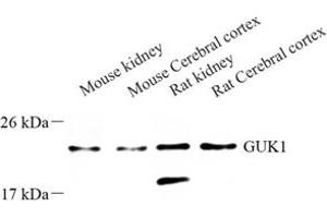 Western blot analysis of GUK1 (ABIN7074153) at dilution of 1: 500 (GUK1 Antikörper)