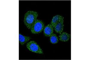 Image no. 3 for anti-Acyl-CoA Synthetase Long-Chain Family Member 4 (ACSL4) (AA 244-274) antibody (ABIN357780) (ACSL4 Antikörper  (AA 244-274))