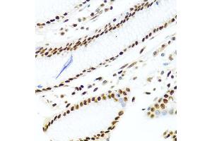 Immunohistochemistry of paraffin-embedded human stomach using SSB antibody at dilution of 1:100 (40x lens). (SSB Antikörper)