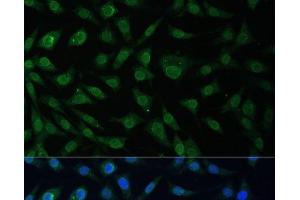 Immunofluorescence analysis of L929 cells using NUP214 Polyclonal Antibody at dilution of 1:100 (40x lens). (NUP214 Antikörper)