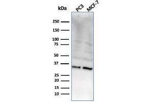 Western Blot Analysis of PC3 and MCF-7 cell lysate using NKX2. (NKX2-8 Antikörper  (AA 10-123))