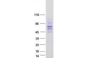 Validation with Western Blot (SIGIRR Protein (Transcript Variant 3) (Myc-DYKDDDDK Tag))