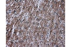 Immunohistochemical staining of paraffin-embedded liver tissue using anti-FAHD2A mouse monoclonal antibody. (FAHD2A Antikörper)