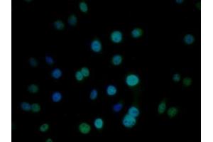 Detection of CIRBP in Human HepG2 cell using Polyclonal Antibody to Cold Inducible RNA Binding Protein (CIRBP) (CIRBP Antikörper  (AA 1-172))