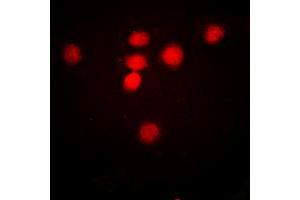 Immunofluorescent analysis of CBP (AcK1535) staining in HeLa cells.