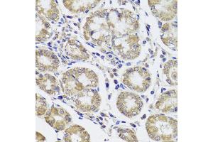 Immunohistochemistry of paraffin-embedded human stomach using CTSC antibody (ABIN5974676) at dilution of 1/100 (40x lens). (CTSC Antikörper)