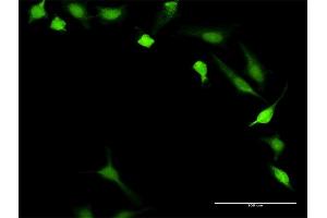 Immunofluorescence of purified MaxPab antibody to PPP3R1 on HeLa cell.