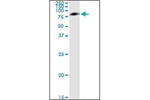 Western Blotting (WB) image for anti-Serpin Peptidase Inhibitor, Clade G (C1 Inhibitor), Member 1 (SERPING1) (AA 1-501) antibody (ABIN782340)
