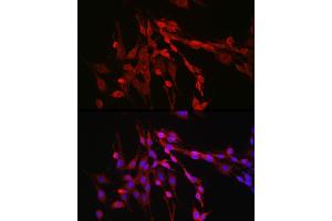 Immunofluorescence analysis of PC-12 cells using Inhibin beta A (INHBA) Rabbit pAb (ABIN6129032, ABIN6142459, ABIN6142460 and ABIN6221533) at dilution of 1:50 (40x lens). (INHBA Antikörper  (AA 21-426))