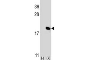 Western blot analysis of IL-17 antibody and 293 cell lysate (2 ug/lane) either nontransfected (Lane 1) or transiently transfected (2) with the IL17A gene.