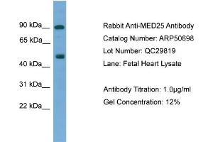 WB Suggested Anti-MED25  Antibody Titration: 0. (MED25 Antikörper  (N-Term))