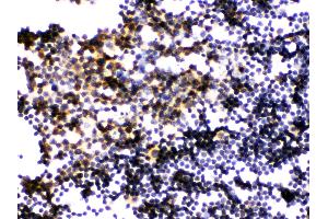 Anti- PLK1 Picoband antibody,IHC(P) IHC(P): Mouse Lymphaden Tissue
