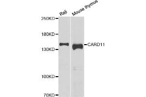 Western blot analysis of extracts of various cell lines, using CARD11 antibody (ABIN5974295) at 1/1000 dilution. (CARD11 Antikörper)