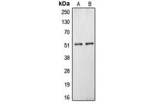 Western blot analysis of Carboxypeptidase N 1 expression in HepG2 (A), HEK293T (B) whole cell lysates. (CPN1 Antikörper  (C-Term))