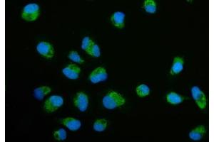 IF analysis of ECSIT using anti-ECSIT antibody (ABIN7602543). (ECSIT Antikörper  (AA 83-339))