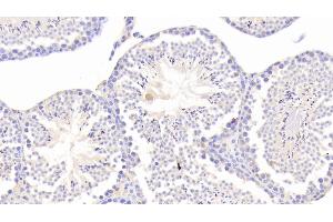 Detection of CHRDL1 in Mouse Testis Tissue using Polyclonal Antibody to Chordin Like Protein 1 (CHRDL1) (CHRDL1 Antikörper  (AA 272-447))