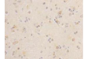 Immunohistochemistry (Paraffin-embedded Sections) (IHC (p)) image for anti-Leucine-Rich Repeat Containing G Protein-Coupled Receptor 5 (LGR5) antibody (ABIN1112906) (LGR5 Antikörper)