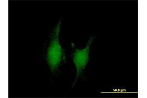 Immunofluorescence of purified MaxPab antibody to TRAF5 on HeLa cell.