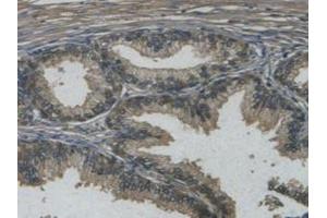 IHC-P analysis of Human Prostate Gland Tissue, with DAB staining. (REG3g Antikörper  (AA 39-175))