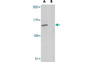Western blot analysis of GP6 in A-20 lysate with GP6 polyclonal antibody  at 1 ug/m in either the absence or (B) the presence of blocking peptide. (GP6 Antikörper  (C-Term))