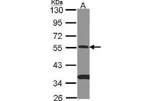 WB Image Sample (30 ug of whole cell lysate) A: NT2D1 10% SDS PAGE antibody diluted at 1:500 (SMAD9 Antikörper)
