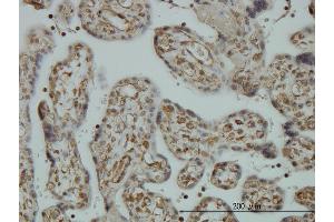 Immunoperoxidase of monoclonal antibody to CNAP1 on formalin-fixed paraffin-embedded human placenta. (NCAPD2 Antikörper  (AA 1240-1339))