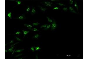 Immunofluorescence of monoclonal antibody to ZSCAN18 on HeLa cell. (ZSCAN18 Antikörper  (AA 1-510))